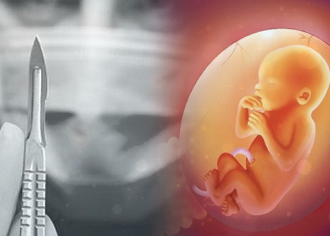 Menjamurnya Aborsi: Hilangnya Fitrah Perempuan Sebagai Rahim Kehidupan