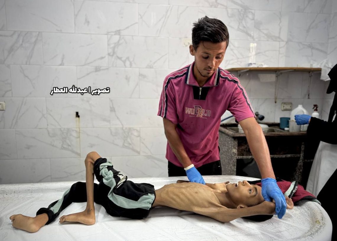 Krisis Kelaparan Gaza Memburuk: Puluhan Warga Tewas, Anak-Anak Jadi Korban Terbesar
